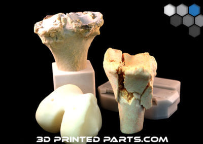 3D Printed Parts for Medical use